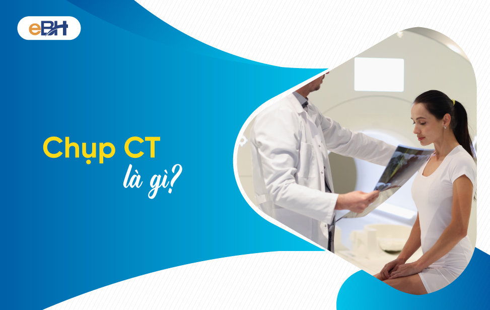 Mức giá chụp CT có được bảo hiểm y tế chi trả không?